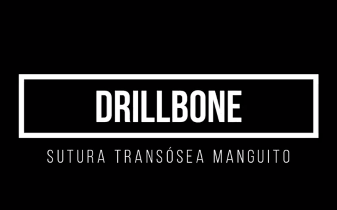 DrillBone – Técnica artroscópica para hombro (actualizada nov. 2023)